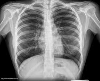 Nuclear Medicine
